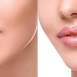 Lip Filler Treatment in Woodbury, MN