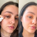 Skin Concerns